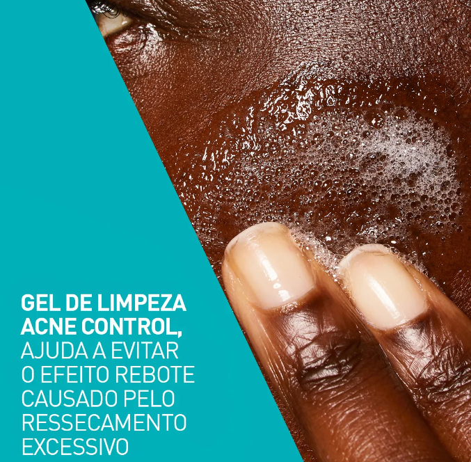 Cerave Gel De Limpeza Acne Control 340g - Imagem 2